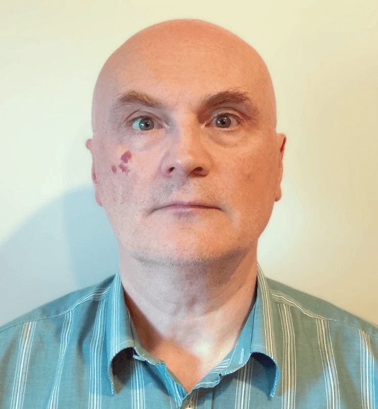 man's head
