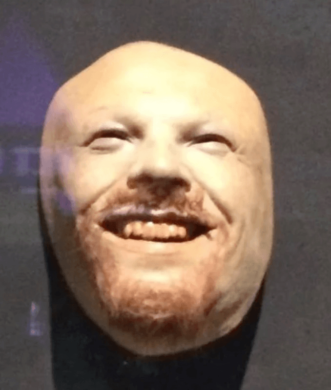 skeleton head