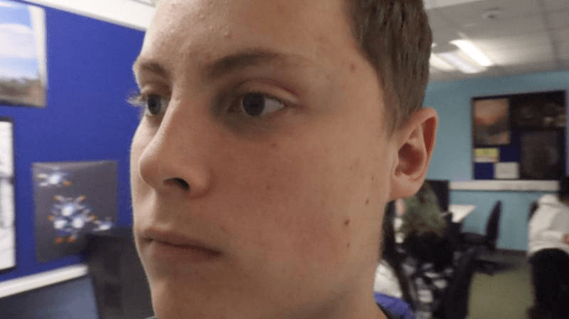 boy's head