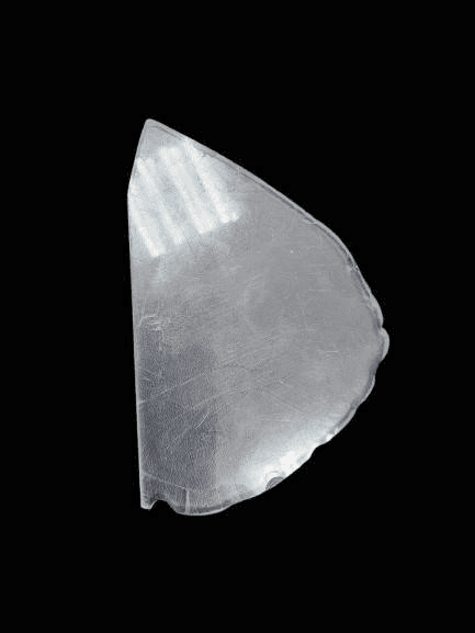 metal artifact