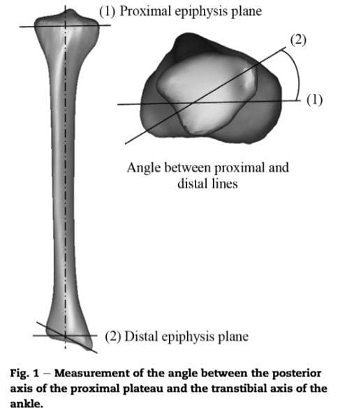 bone diagram